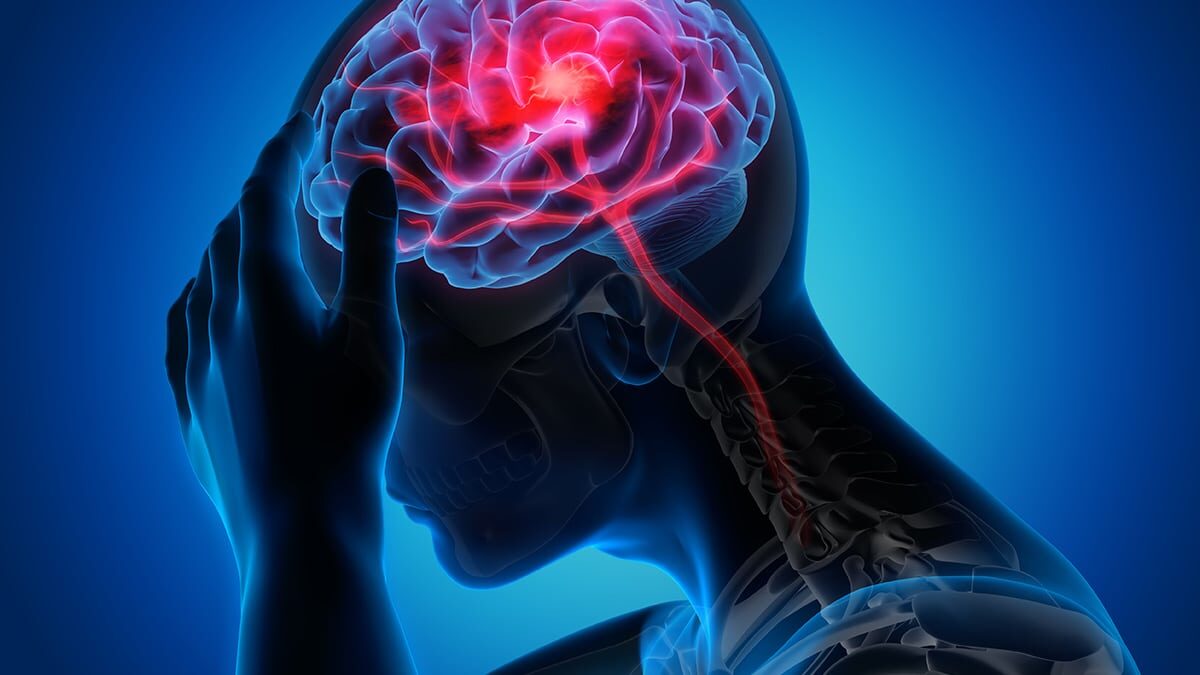 Signs-Symptoms-Stroke